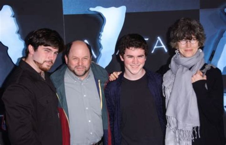 Are Jason Alexander’s Plastic Surgery Rumors True?