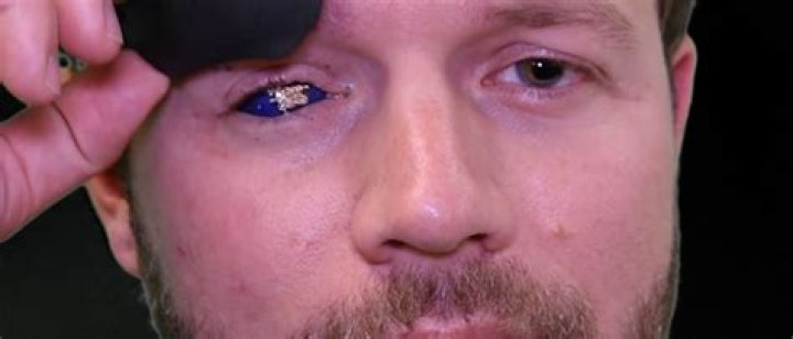 How Did Dan Crenshaw Lose His Eye?