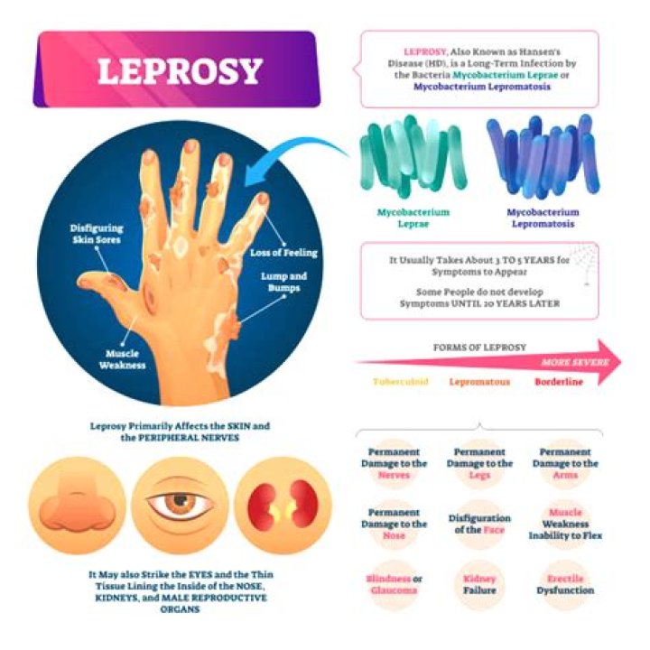Leprosy Cases Are Rising in the U.S.—These Are the Symptoms to Know