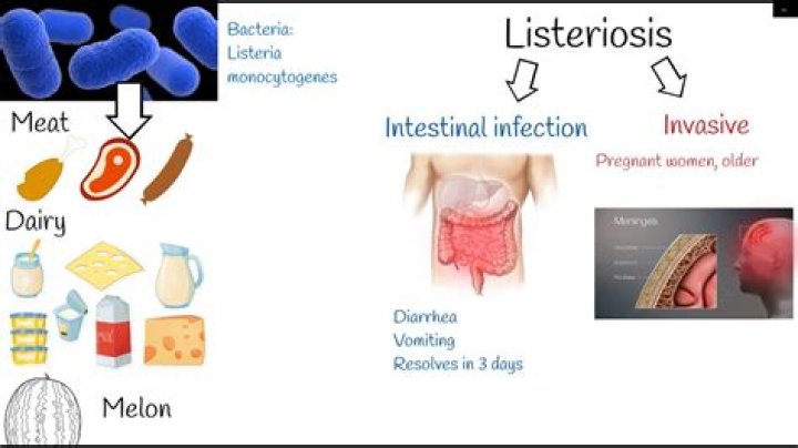 Listeria Outbreak Has Hit 10 States—These Are the Warning Signs of Listeriosis