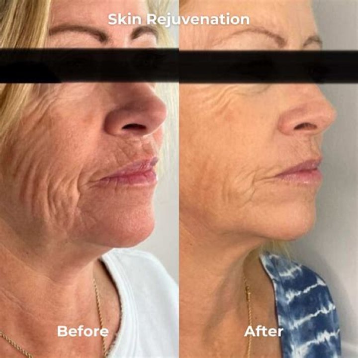 The No. 1 Thing You Shouldn't Be Doing With Your Skin After 50